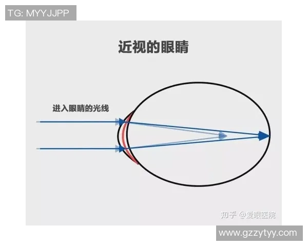 足球明星们的视力状况揭秘是否存在近视问题及其对比赛的影响分析 足球明星们的视力状况揭秘是否存在近视问题及其对比赛的影响分析
